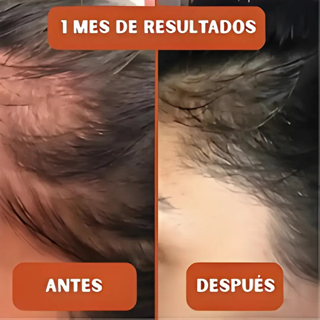 PUMPKIN SEED OIL® Promueve el crecimiento capilar y Alivia la próstata💊