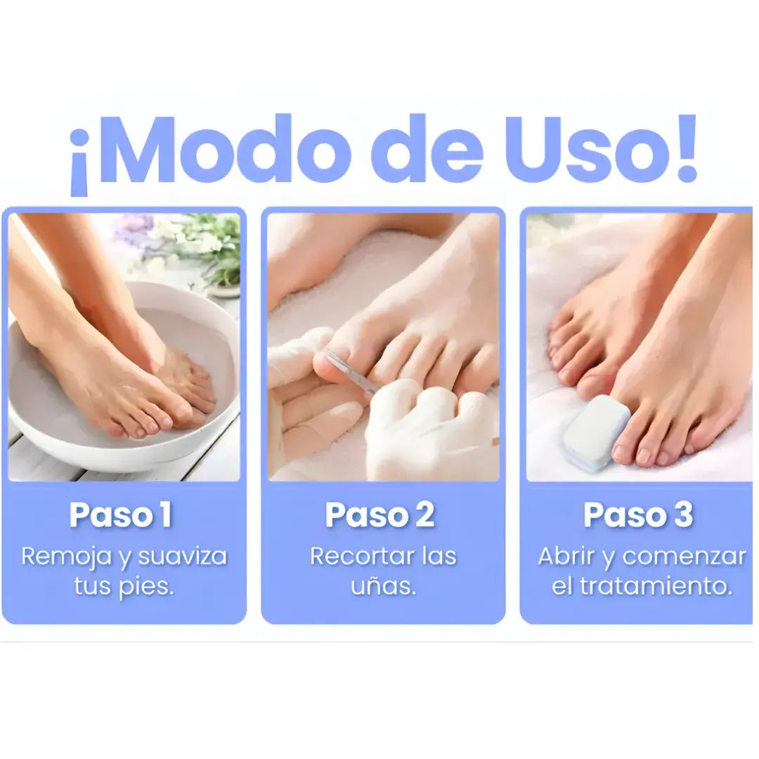 Láser inteligente cuidado de uñas + uso sin dolor + resultados visibles - 2 X 1
