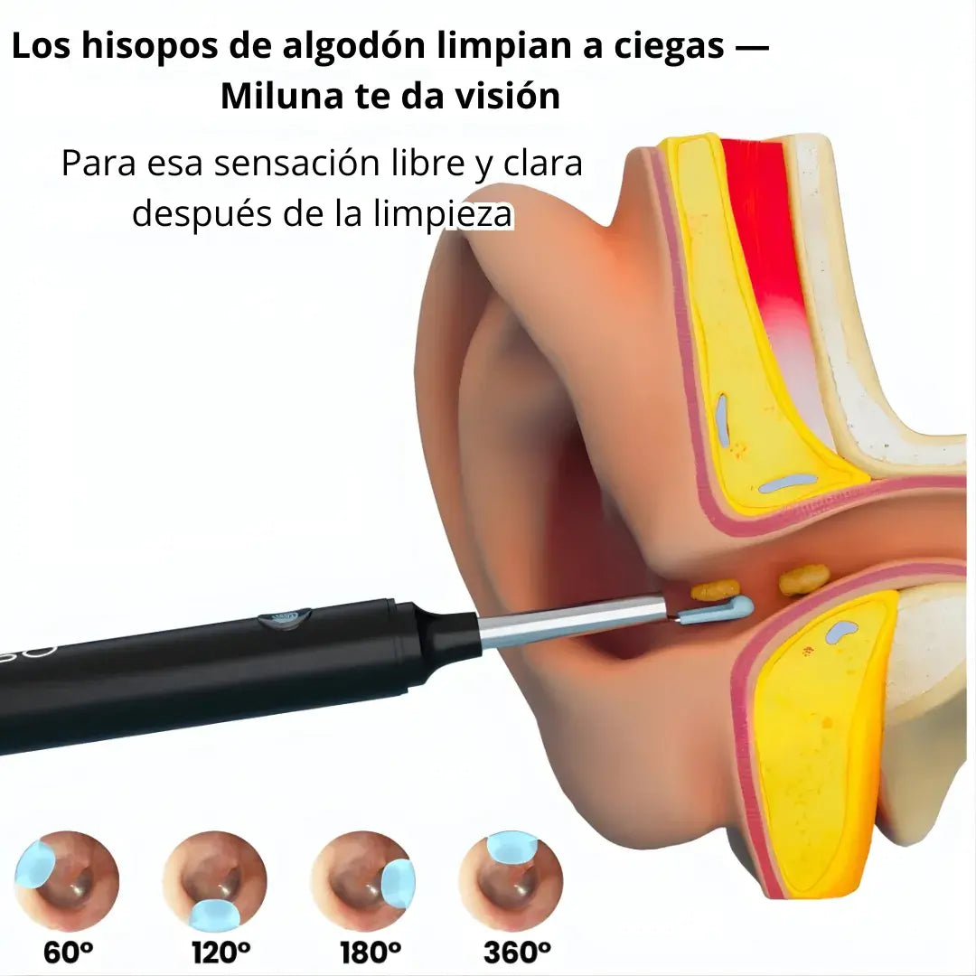 Limpiador auditivo inteligente + cámara HD 1080p + control total desde tu móvil