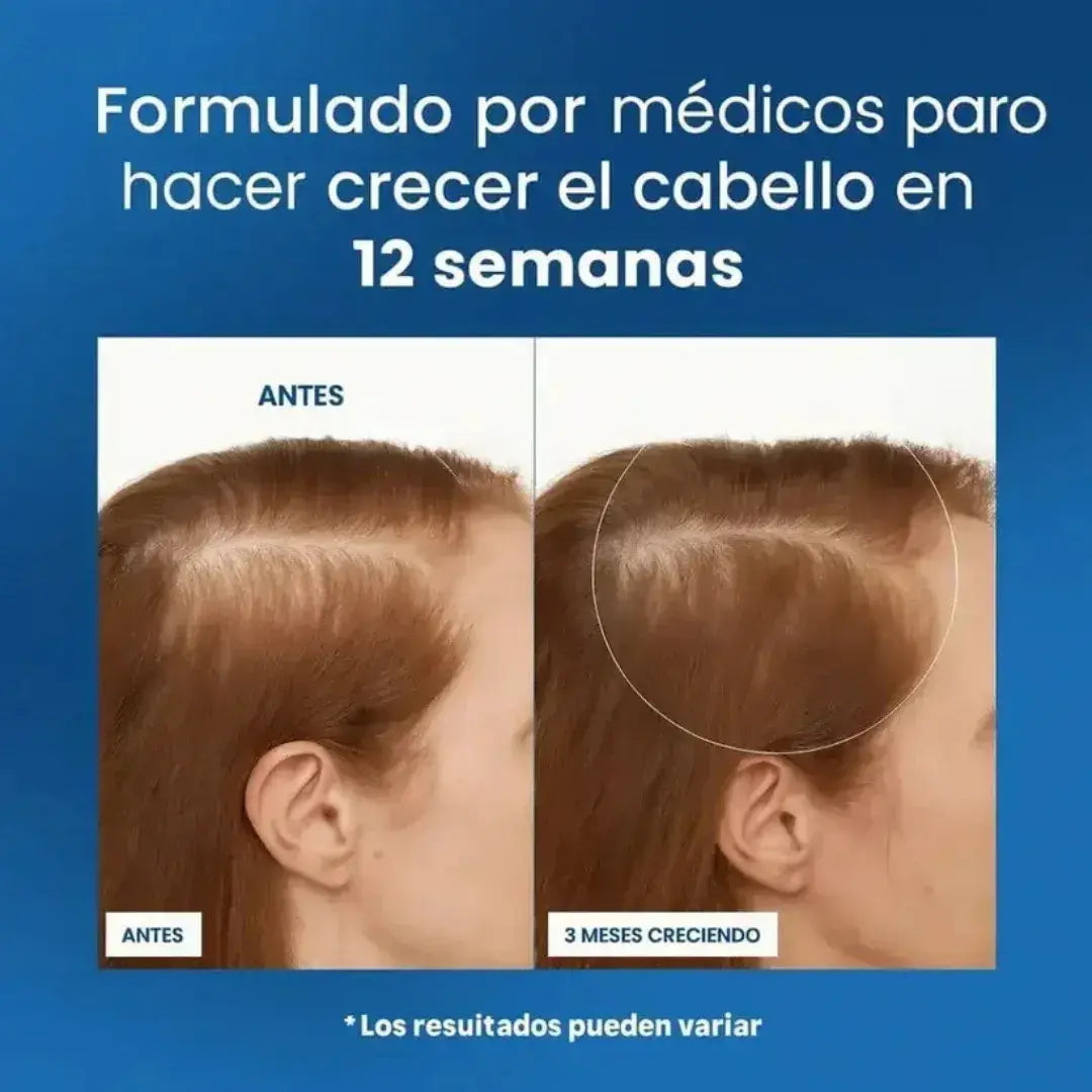 BodyWise®  -Tratamiento capilar profesional- fórmula con extractos naturales - Oferta 2 x 1