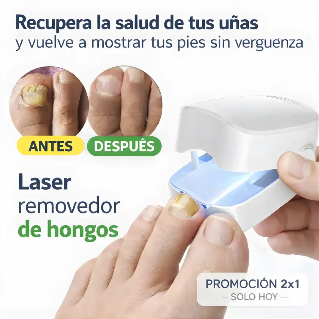 Láser inteligente cuidado de uñas + uso sin dolor + resultados visibles - 2 X 1